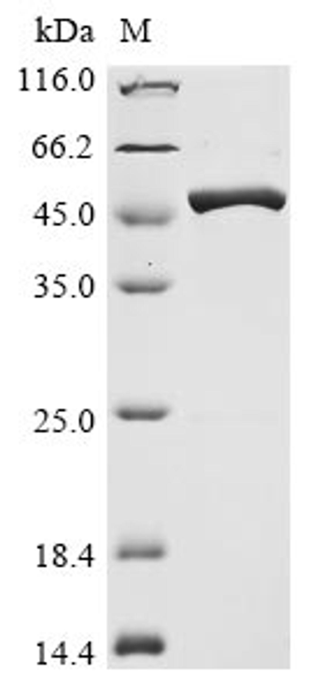 (Tris-Glycine gel) Discontinuous SDS-PAGE (reduced) with 5% enrichment gel and 15% separation gel.