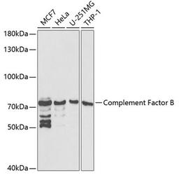 Western blot - Complement Factor B antibody (A1706)