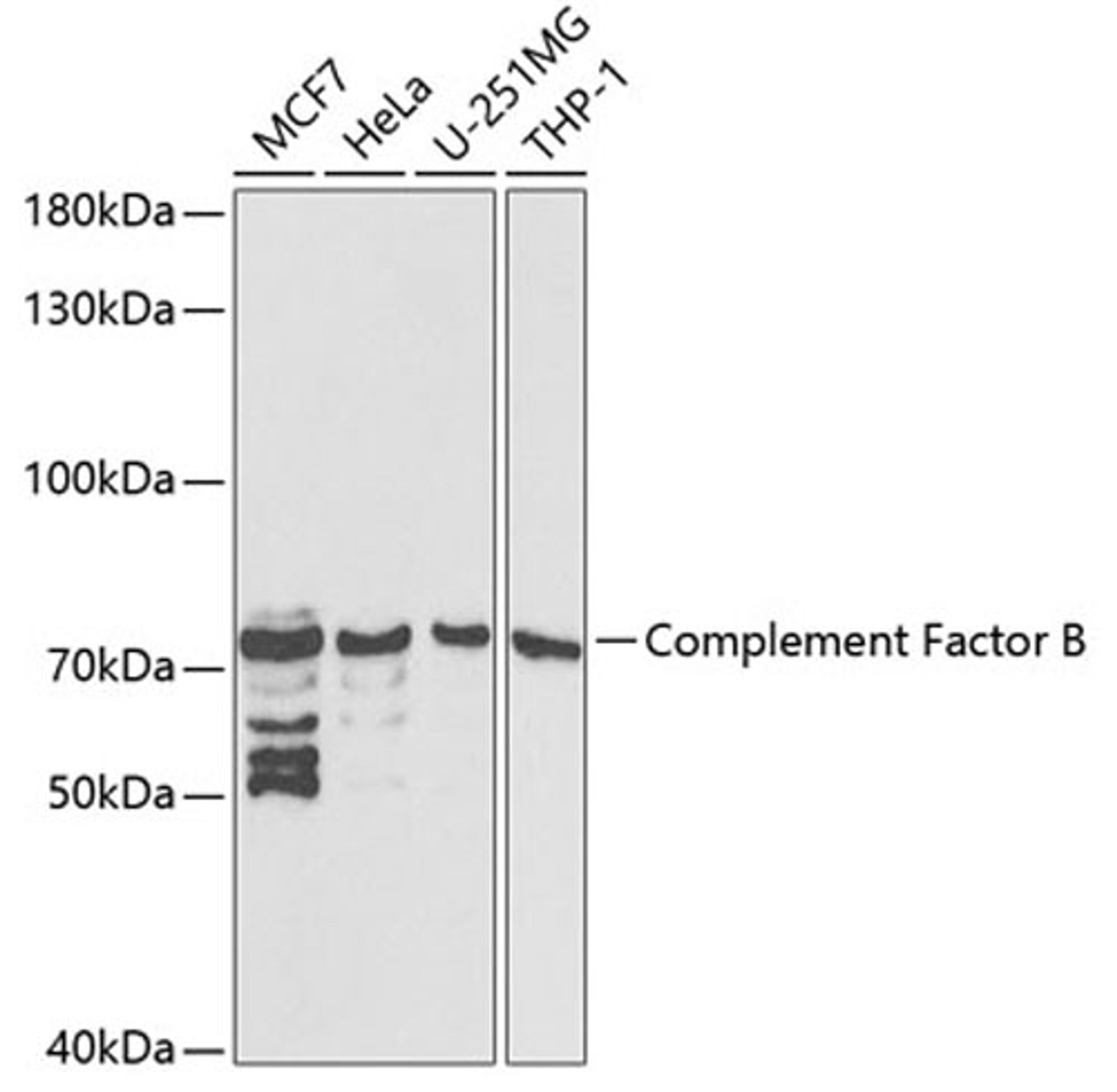 Western blot - Complement Factor B antibody (A1706)