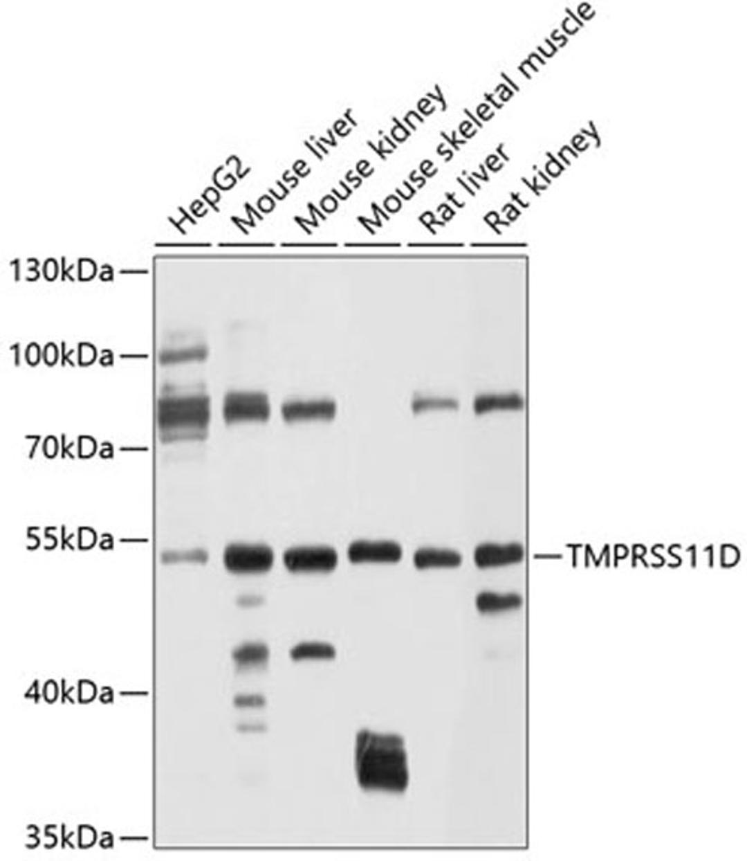 Western blot - TMPRSS11D antibody (A10132)