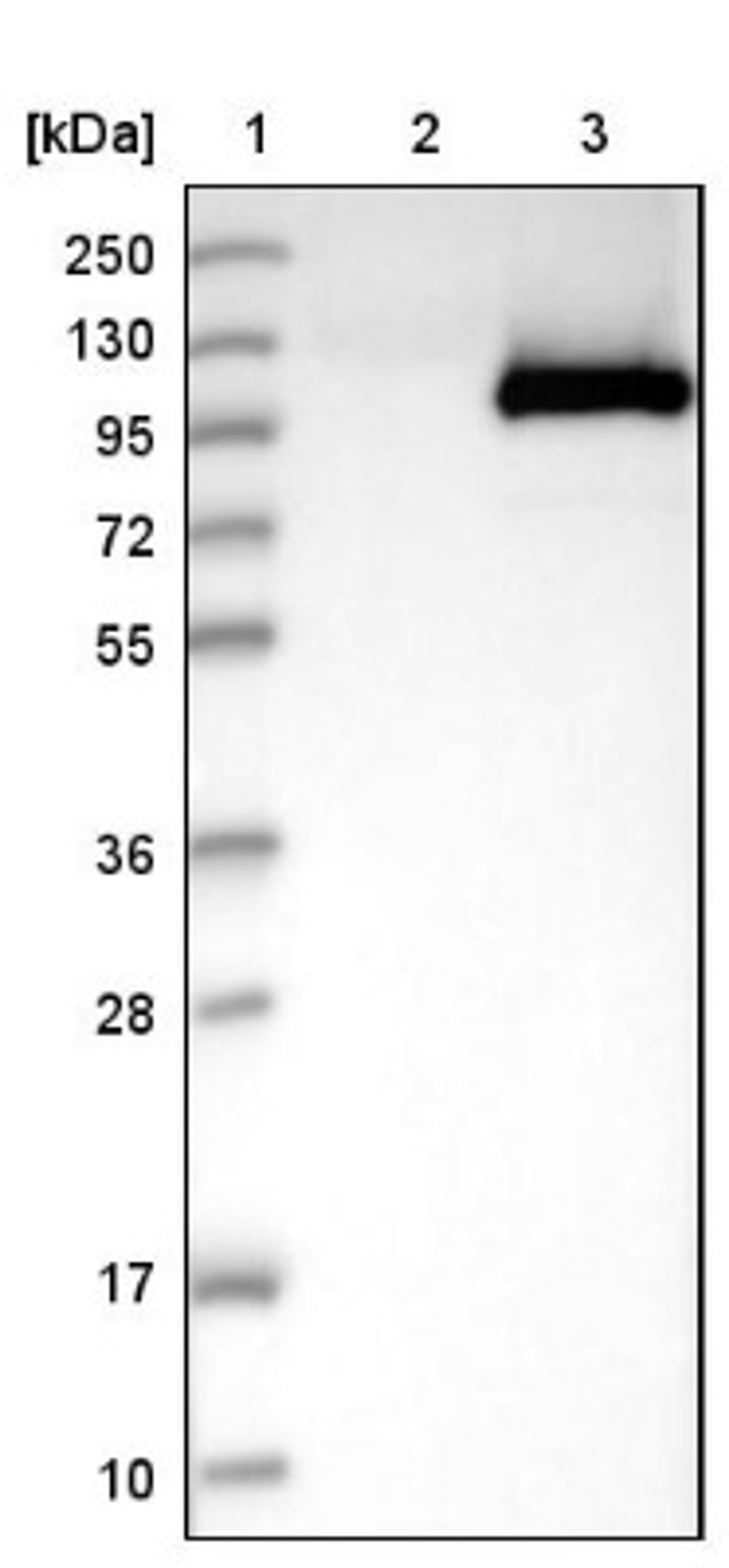 Western Blot: MX2 Antibody [NBP1-81018] - Lane 1: Marker [kDa] 250, 130, 95, 72, 55, 36, 28, 17, 10<br/>Lane 2: Negative control (vector only transfected HEK293T lysate)<br/>Lane 3: Over-expression lysate (Co-expressed with a C-terminal myc-DDK tag (~3.1 kDa) in mammalian HEK293T cells, LY419297)