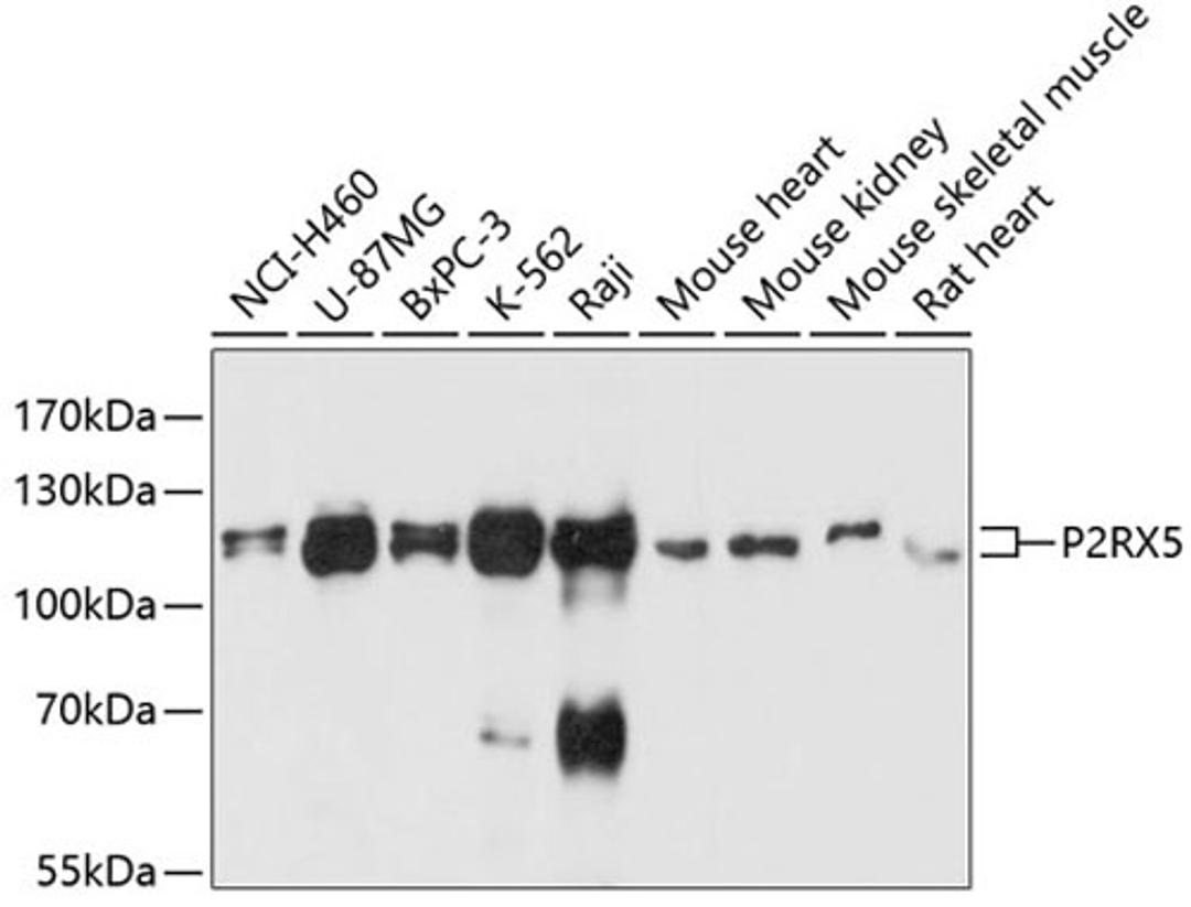 Western blot - P2RX5 antibody (A11710)