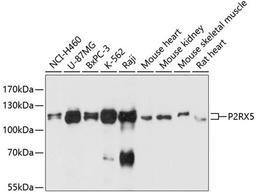 Western blot - P2RX5 antibody (A11710)