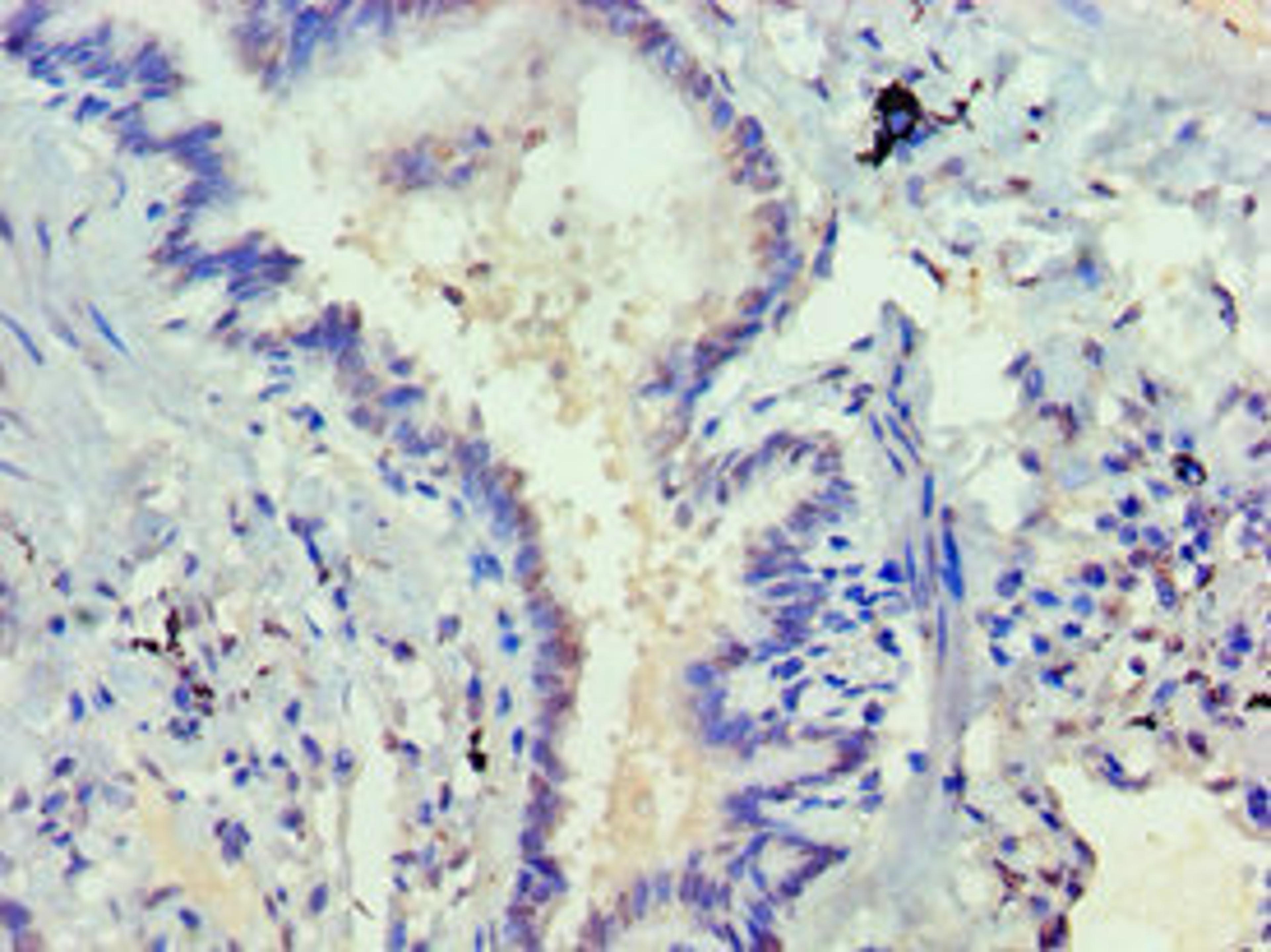 Immunohistochemistry of paraffin-embedded human lung tissue using CSB-PA007286ESR2HU at dilution of 1:100