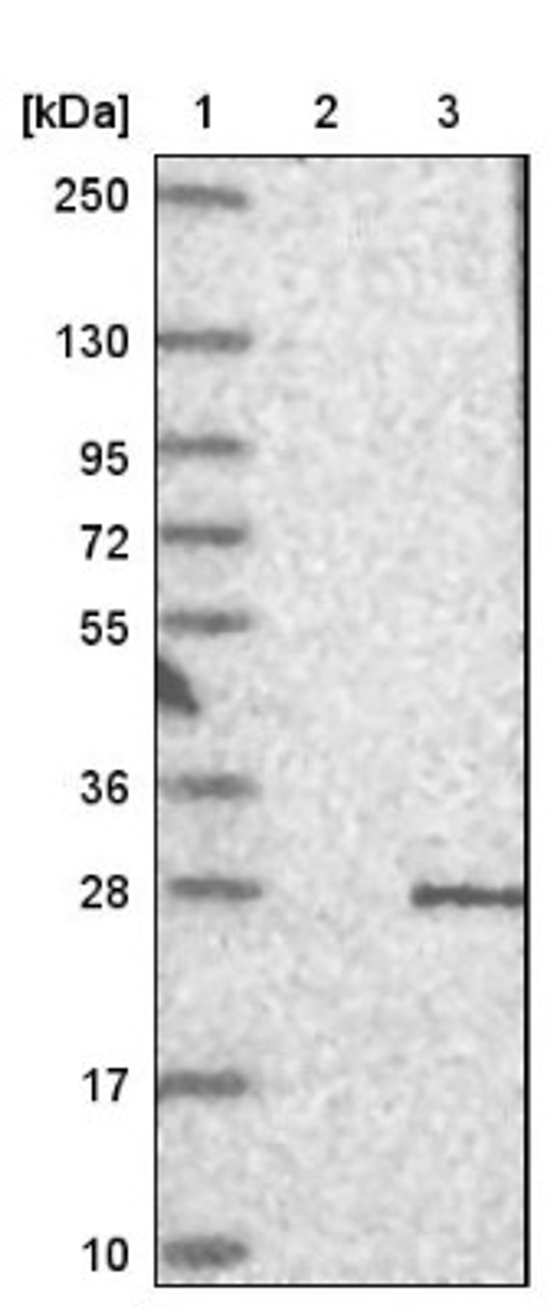 Western Blot: PERP Antibody [NBP1-85173] - Lane 1: Marker [kDa] 250, 130, 95, 72, 55, 36, 28, 17, 10<br/>Lane 2: Negative control (vector only transfected HEK293T lysate)<br/>Lane 3: Over-expression lysate (Co-expressed with a C-terminal myc-DDK tag (~3.1 kDa) in mammalian HEK293T cells, LY411759)