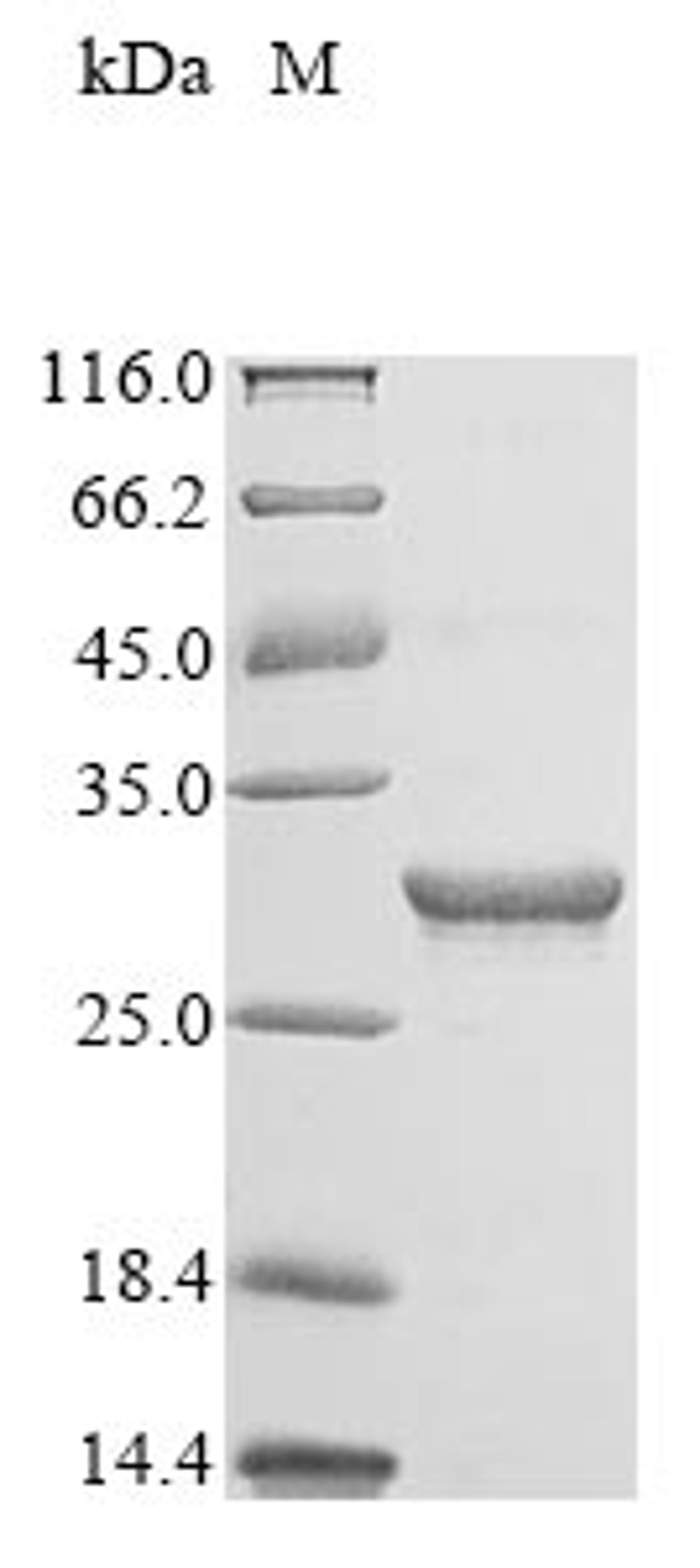 (Tris-Glycine gel) Discontinuous SDS-PAGE (reduced) with 5% enrichment gel and 15% separation gel.