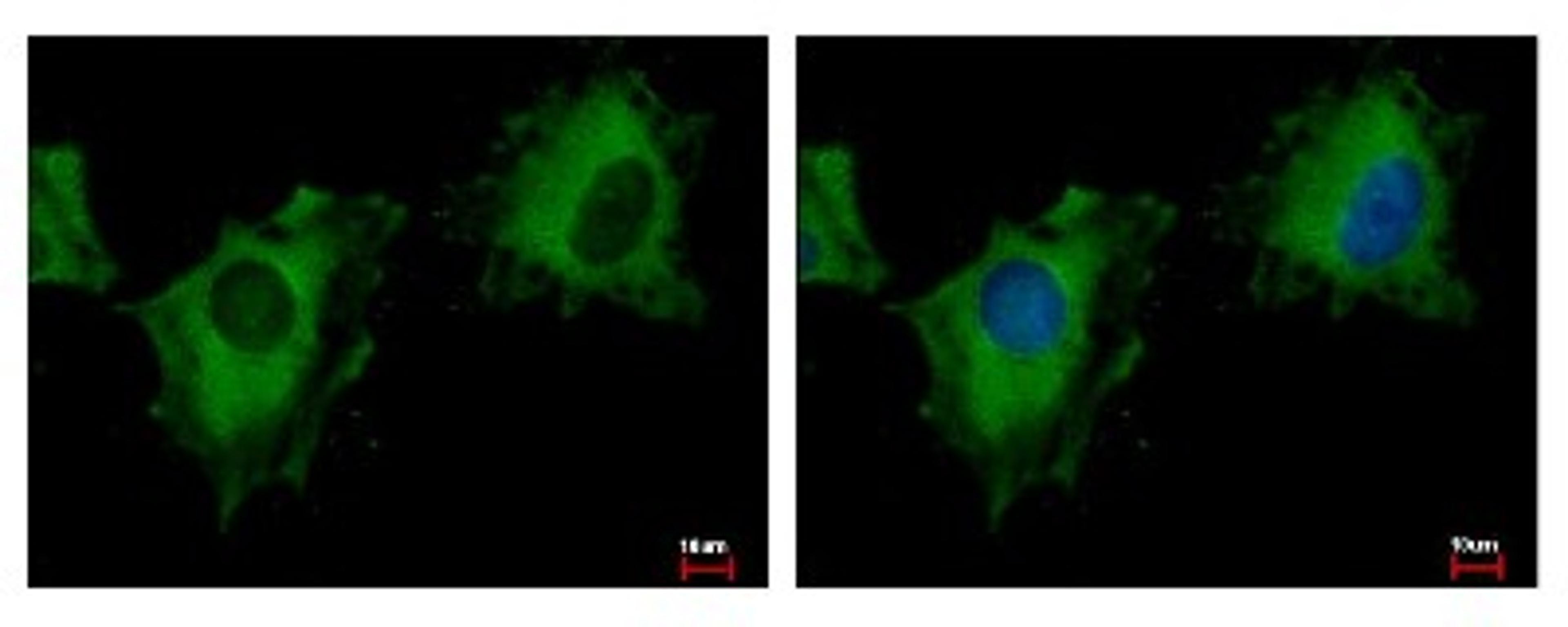 Immunocytochemistry/Immunofluorescence: PITPNM3 Antibody [NBP1-31070] - Sample: HeLa cells were fixed in -20C 100% MeOH for 5 min. Green: PITPNM3 protein stained by NIR1 antibody, C-term diluted at 1:500. Blue: Hoechst 33343 staining.