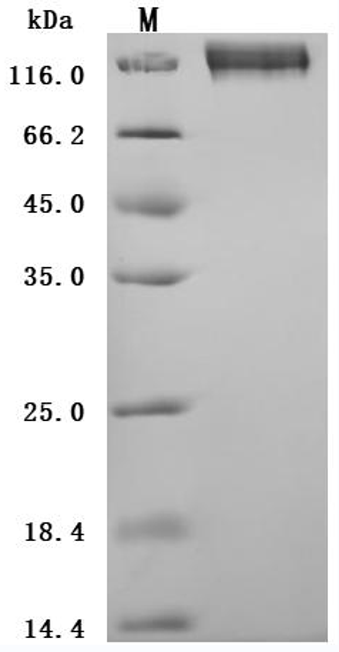 (Tris-Glycine gel) Discontinuous SDS-PAGE (reduced) with 5% enrichment gel and 15% separation gel.