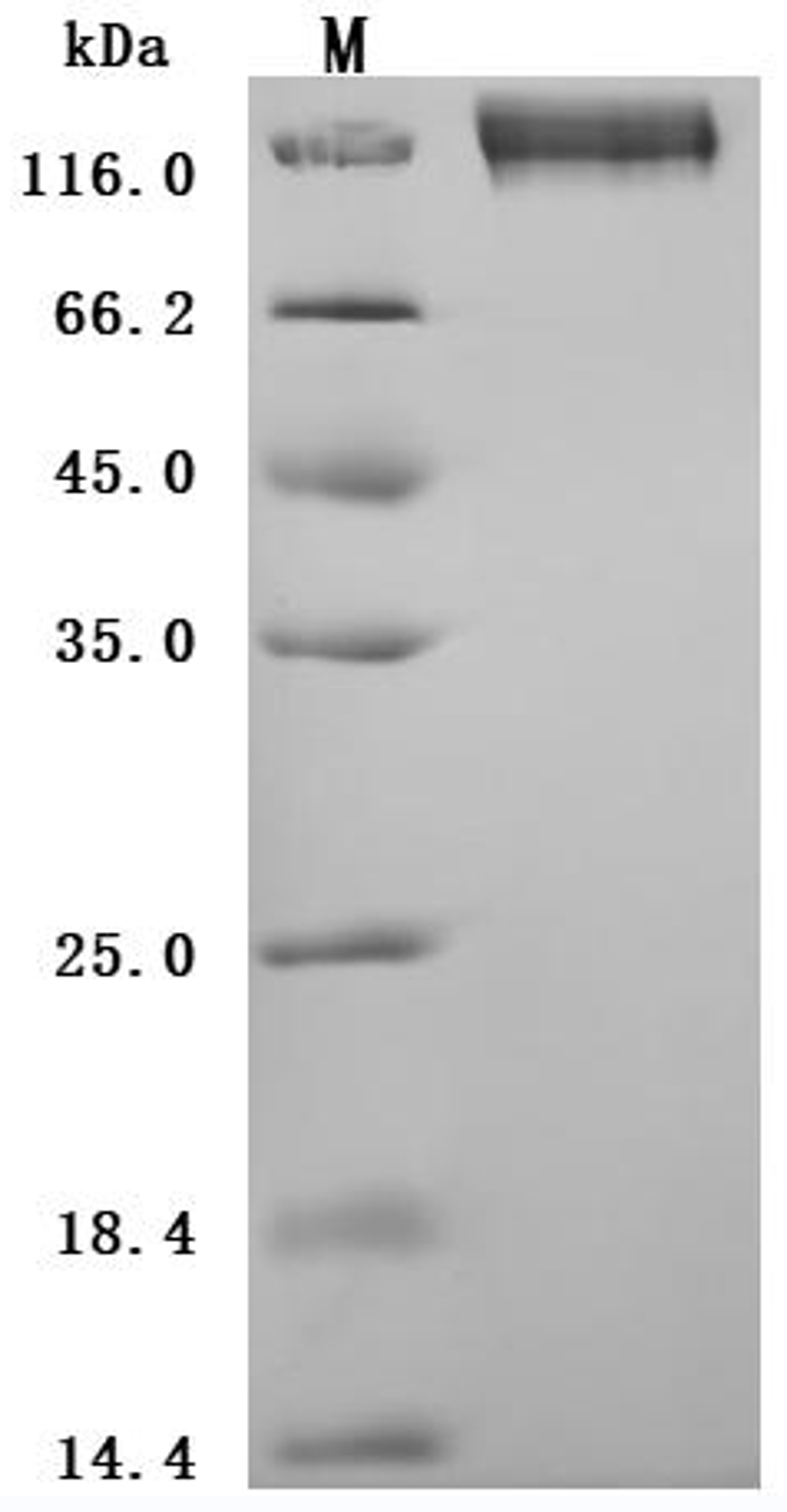 (Tris-Glycine gel) Discontinuous SDS-PAGE (reduced) with 5% enrichment gel and 15% separation gel.