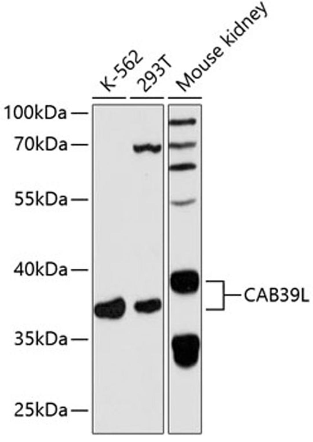 Western blot - CAB39L antibody (A5017)