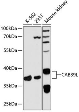 Western blot - CAB39L antibody (A5017)