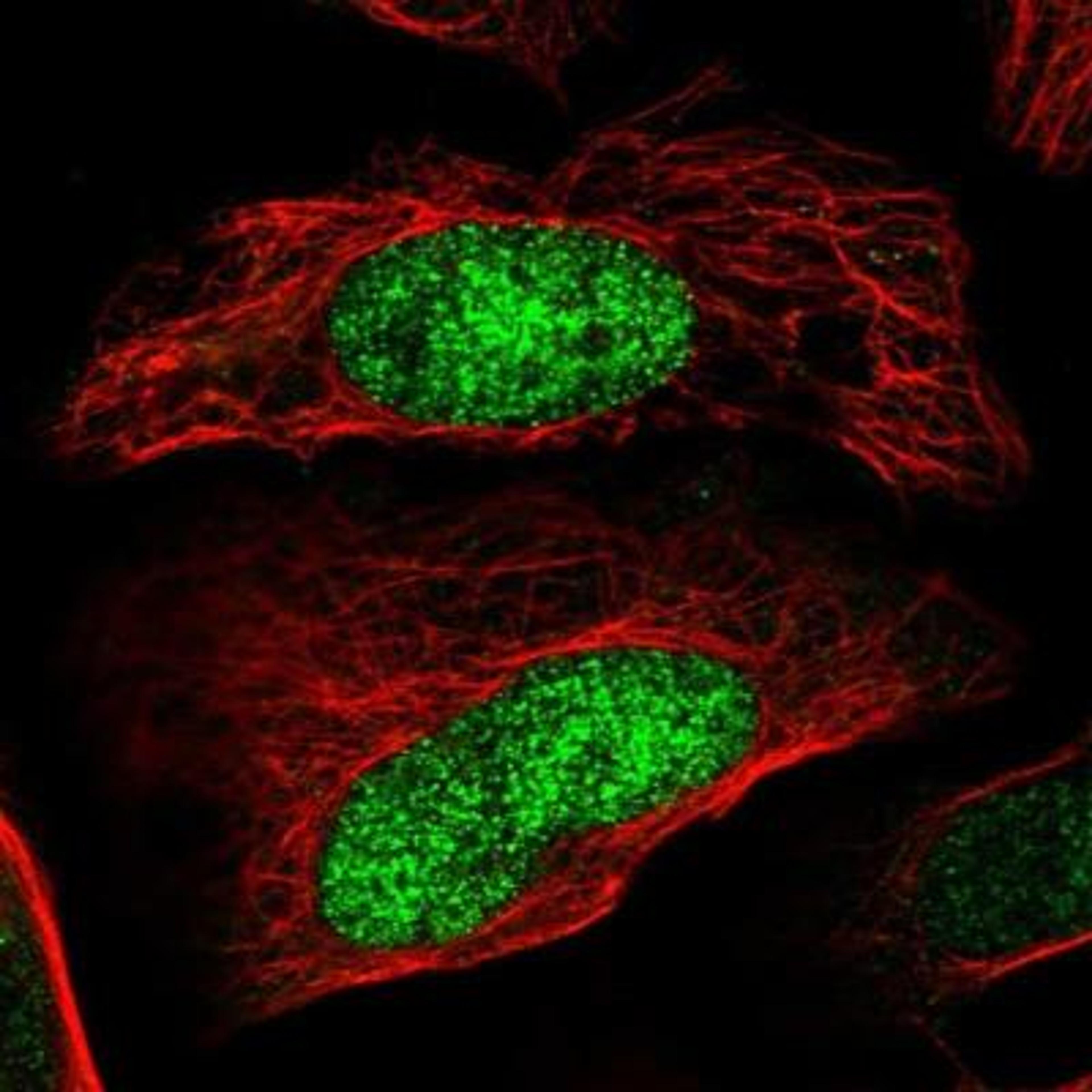 Immunocytochemistry/ Immunofluorescence: BBS7 Antibody [NBP1-88690] - Staining of human cell line U-2 OS shows positivity in nucleus.