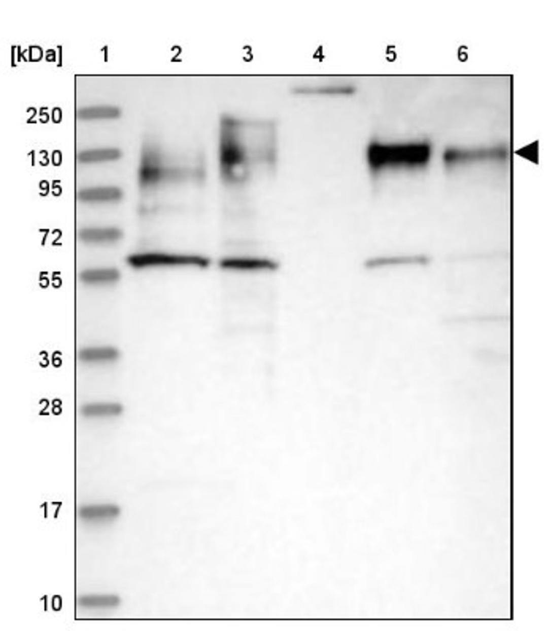 Western Blot: MAP4 Antibody [NBP1-89483] - Lane 1: Marker [kDa] 250, 130, 95, 72, 55, 36, 28, 17, 10<br/>Lane 2: Human cell line RT-4<br/>Lane 3: Human cell line U-251MG sp<br/>Lane 4: Human plasma (IgG/HSA depleted)<br/>Lane 5: Human liver tissue<br/>Lane 6: Human tonsil tissue