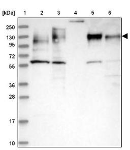 Western Blot: MAP4 Antibody [NBP1-89483] - Lane 1: Marker [kDa] 250, 130, 95, 72, 55, 36, 28, 17, 10<br/>Lane 2: Human cell line RT-4<br/>Lane 3: Human cell line U-251MG sp<br/>Lane 4: Human plasma (IgG/HSA depleted)<br/>Lane 5: Human liver tissue<br/>Lane 6: Human tonsil tissue