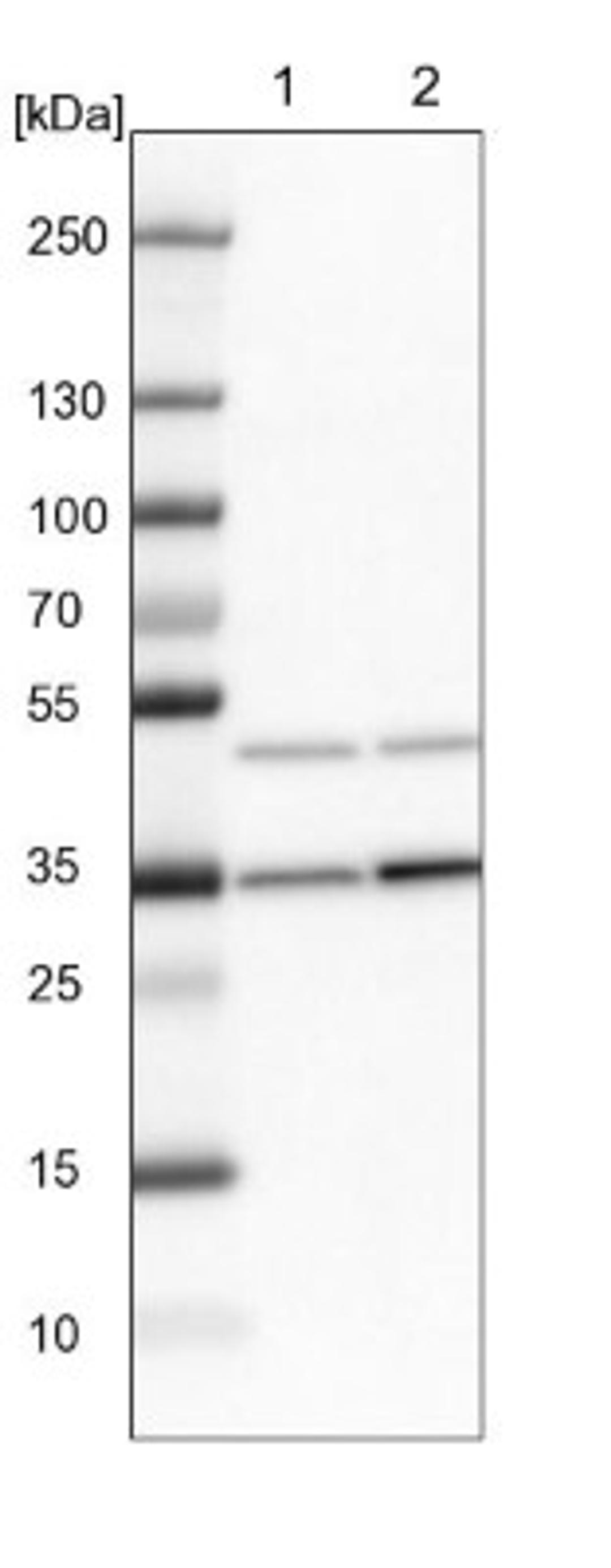 Western Blot: Fbxl8 Antibody [NBP1-83920] - Lane 1: NIH-3T3 cell lysate (Mouse embryonic fibroblast cells)<br/>Lane 2: NBT-II cell lysate (Rat Wistar bladder tumour cells)