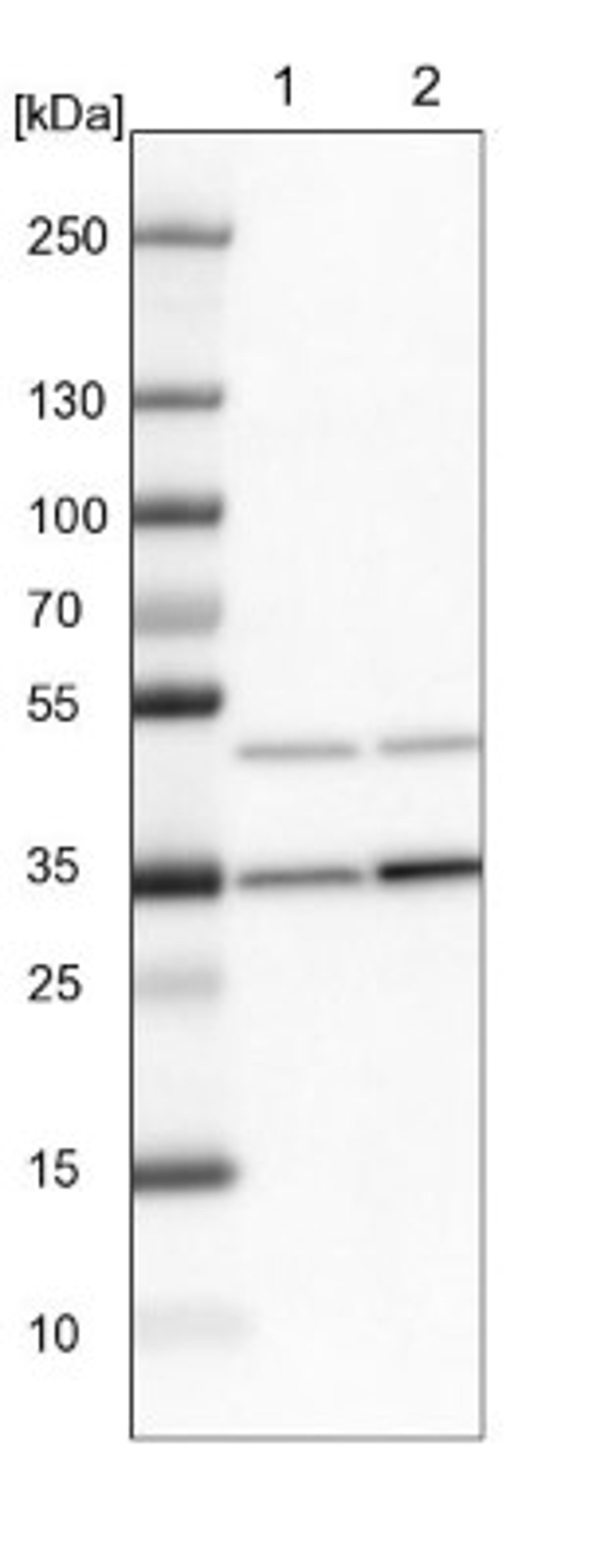 Western Blot: Fbxl8 Antibody [NBP1-83920] - Lane 1: NIH-3T3 cell lysate (Mouse embryonic fibroblast cells)<br/>Lane 2: NBT-II cell lysate (Rat Wistar bladder tumour cells)