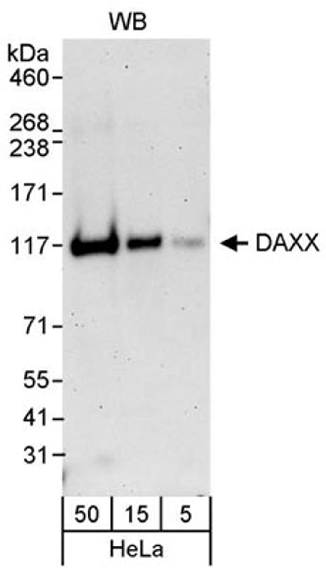 Detection of human DAXX by western blot.