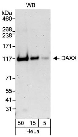 Detection of human DAXX by western blot.