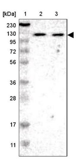 Western Blot: ADNP2 Antibody [NBP1-81468] - Lane 1: Marker [kDa] 230, 130, 95, 72, 56, 36, 28, 17, 11<br/>Lane 2: Human cell line RT-4<br/>Lane 3: Human cell line U-251MG sp