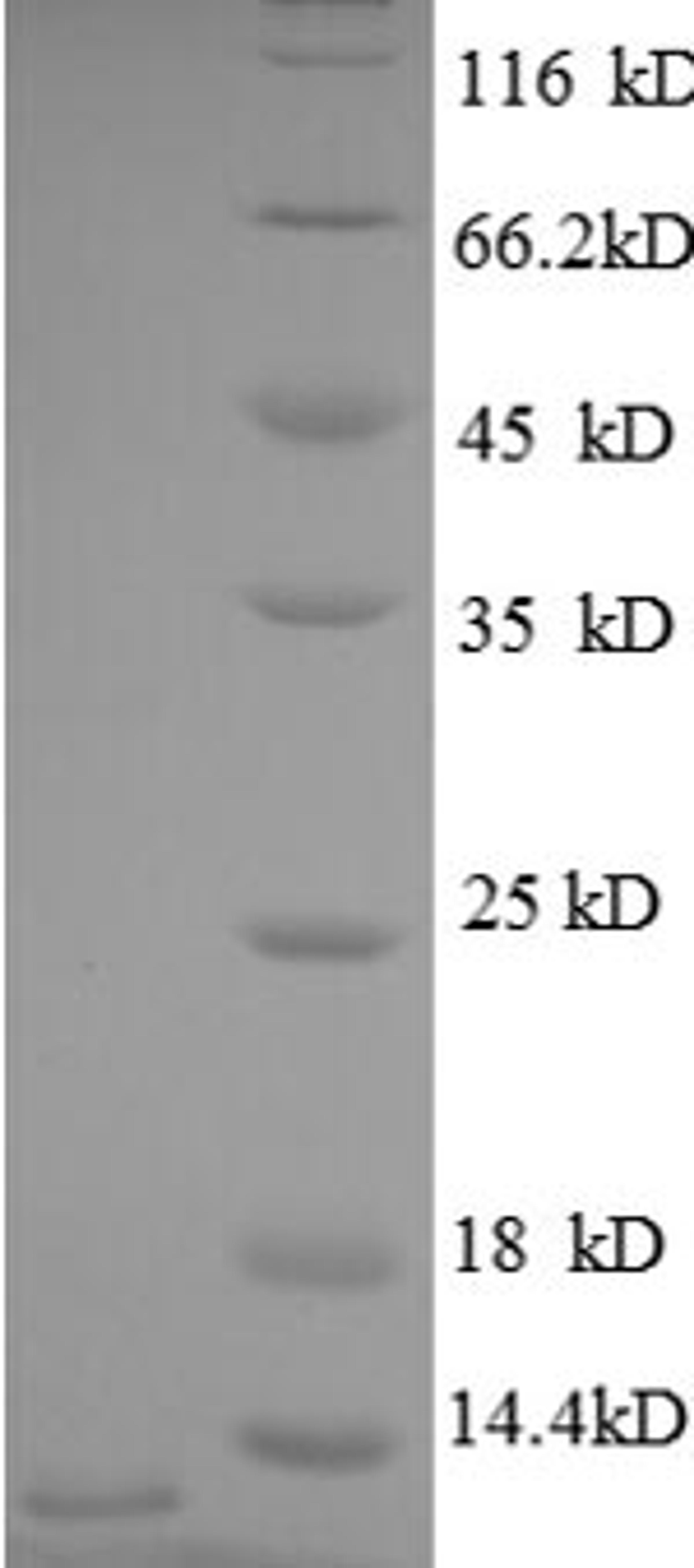 (Tris-Glycine gel) Discontinuous SDS-PAGE (reduced) with 5% enrichment gel and 15% separation gel.