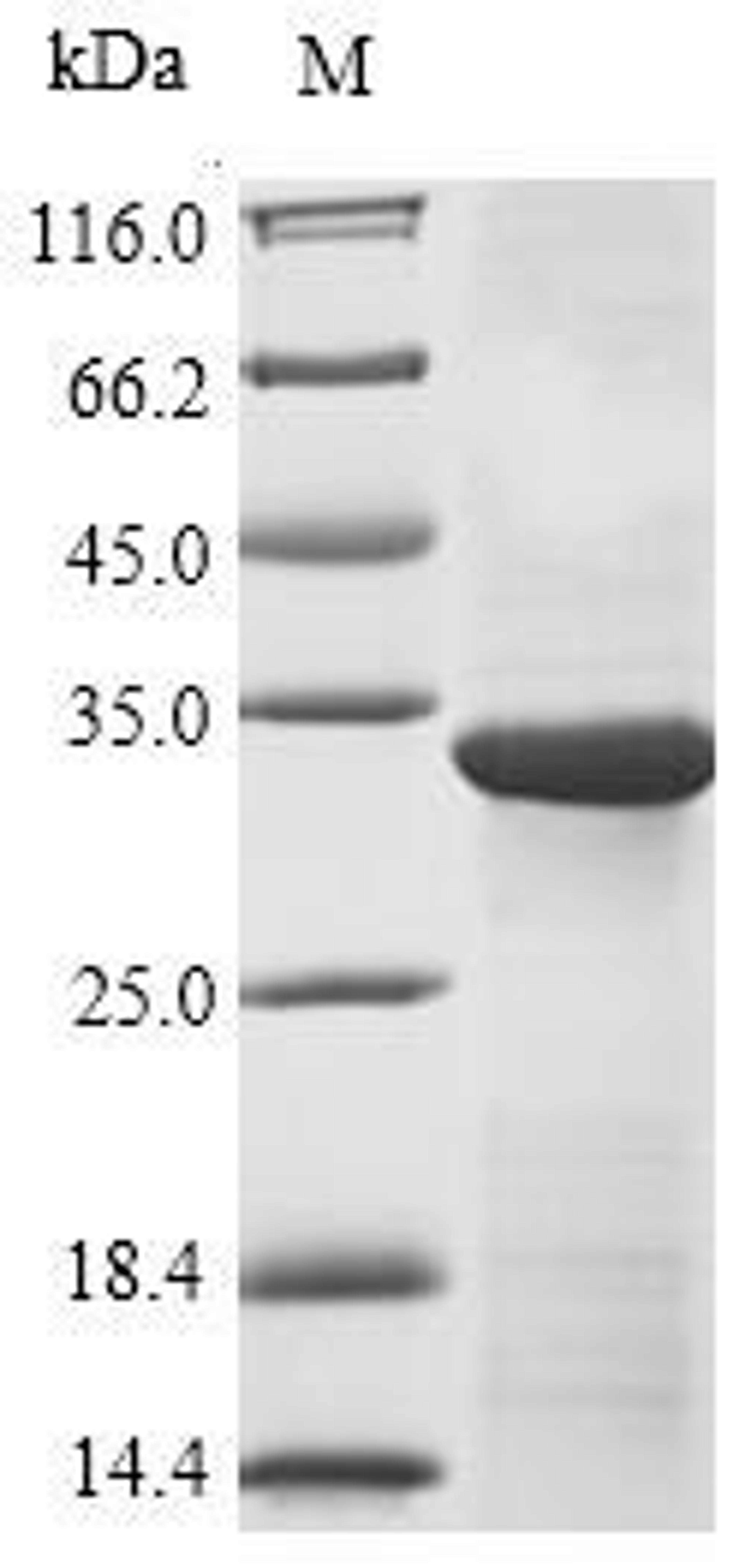 (Tris-Glycine gel) Discontinuous SDS-PAGE (reduced) with 5% enrichment gel and 15% separation gel.
