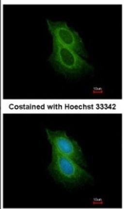 Immunocytochemistry/Immunofluorescence: Spinesin Antibody [NBP2-20474] - Analysis of methanol-fixed MCF-7, using antibody at 1:200 dilution.