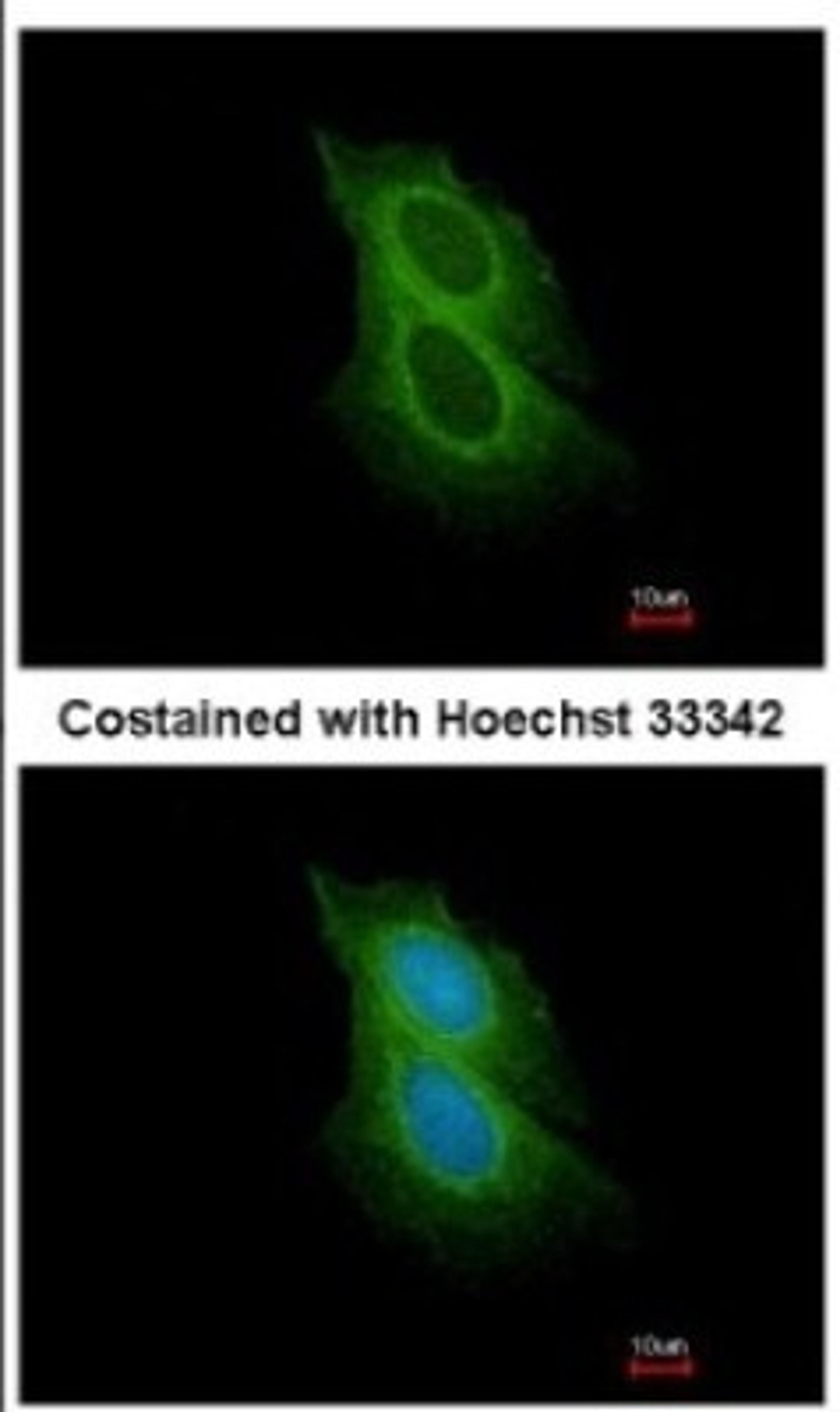 Immunocytochemistry/Immunofluorescence: Spinesin Antibody [NBP2-20474] - Analysis of methanol-fixed MCF-7, using antibody at 1:200 dilution.