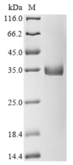 (Tris-Glycine gel) Discontinuous SDS-PAGE (reduced) with 5% enrichment gel and 15% separation gel.