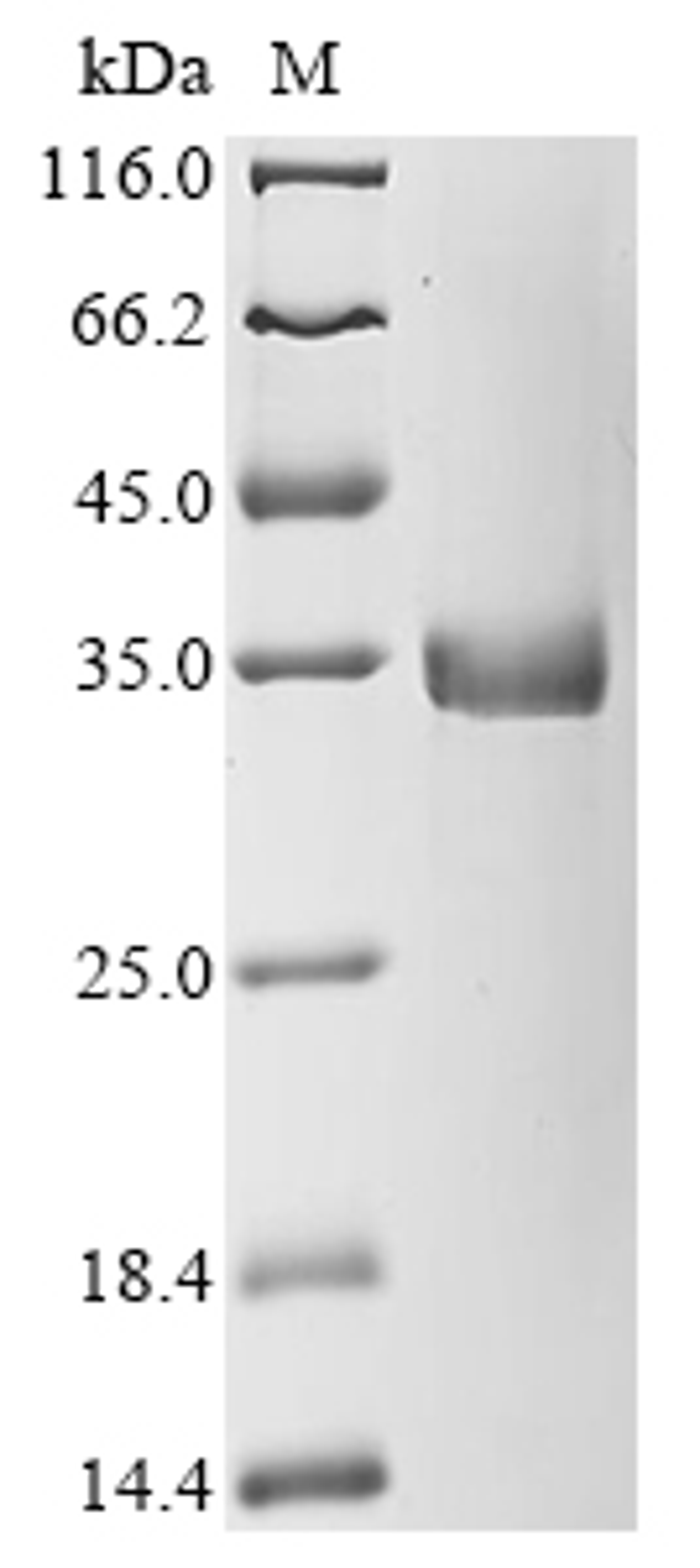 (Tris-Glycine gel) Discontinuous SDS-PAGE (reduced) with 5% enrichment gel and 15% separation gel.