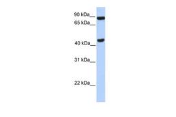 Antibody used in WB on Transfected 293T at 0.2-1 ug/ml.