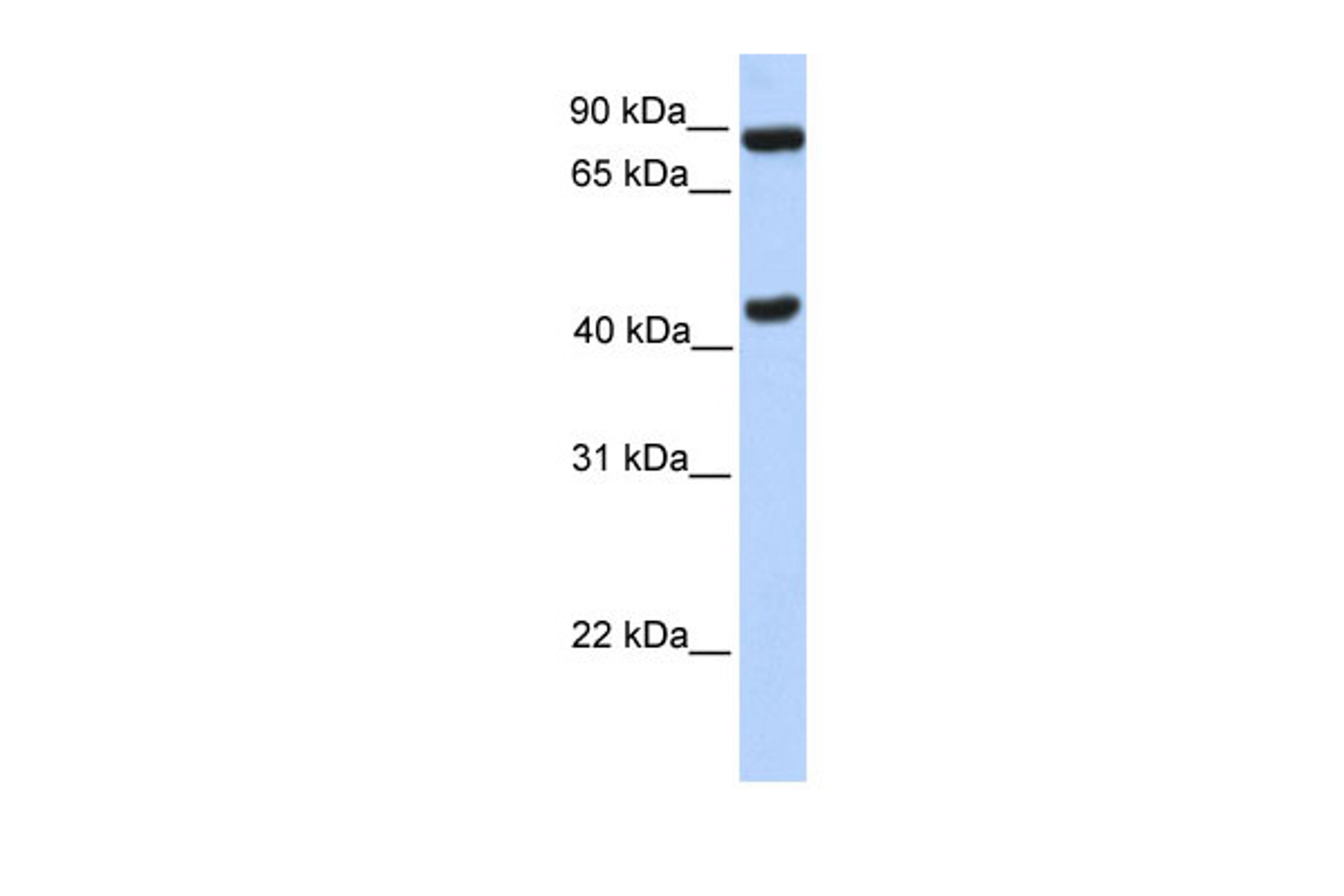 Antibody used in WB on Transfected 293T at 0.2-1 ug/ml.