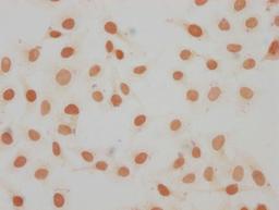 Immunocytochemistry analysis of CSB-PA010087OA11me1HU diluted at 1:15 and staining in Hela cells performed on a Leica BondTM system. The cells were fixed in 4% formaldehyde, permeabilized using 0.2% Triton X-100 and blocked with 10% normal goat serum 30min at RT. Then primary antibody (1% BSA) was incubated at 4°C overnight. The primary is detected by a biotinylated secondary antibody and visualized using an HRP conjugated SP system.