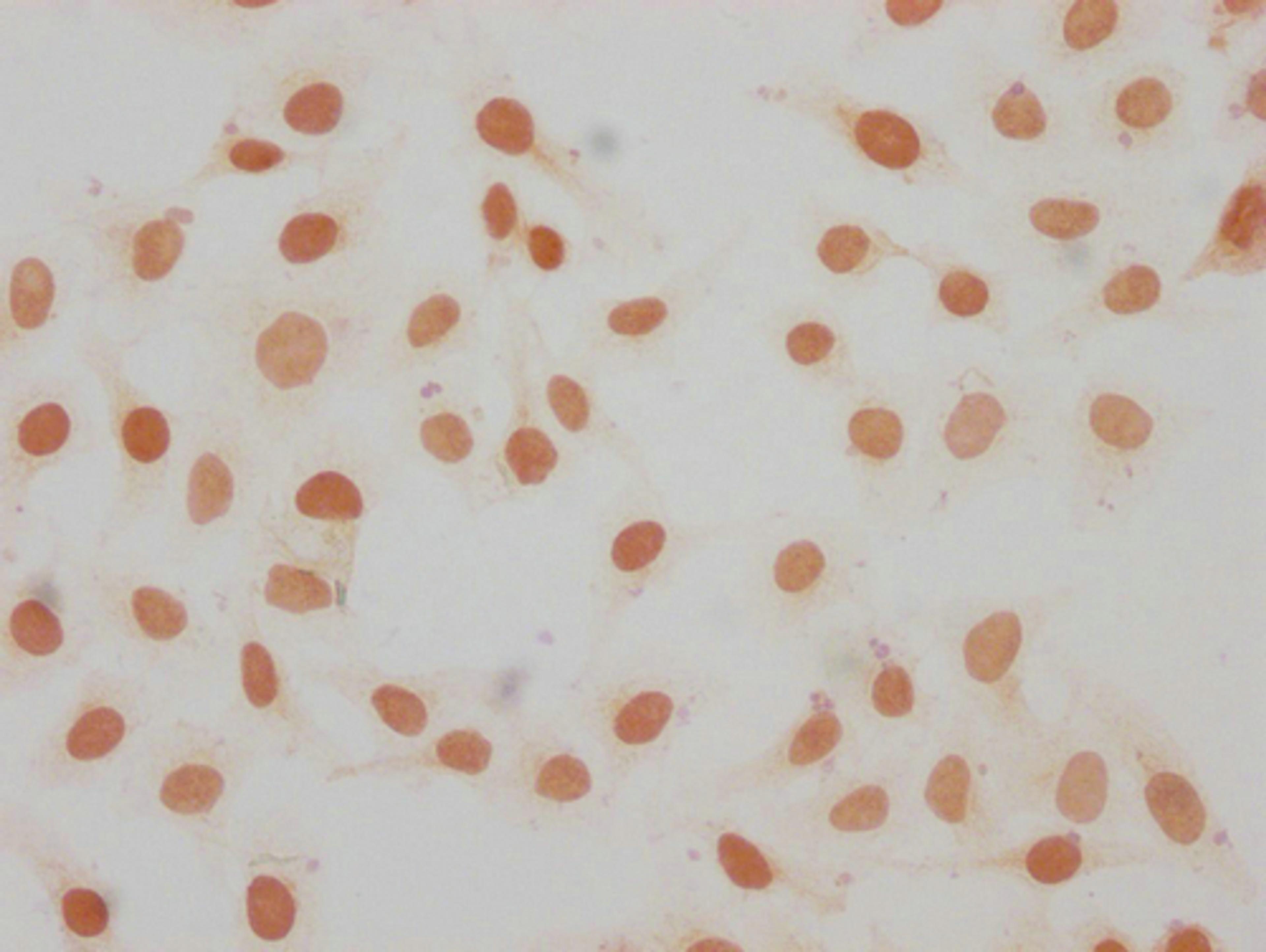 Immunocytochemistry analysis of CSB-PA010087OA11me1HU diluted at 1:15 and staining in Hela cells performed on a Leica BondTM system. The cells were fixed in 4% formaldehyde, permeabilized using 0.2% Triton X-100 and blocked with 10% normal goat serum 30min at RT. Then primary antibody (1% BSA) was incubated at 4°C overnight. The primary is detected by a biotinylated secondary antibody and visualized using an HRP conjugated SP system.
