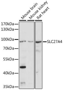 Western blot - SLC27A4 antibody (A16101)