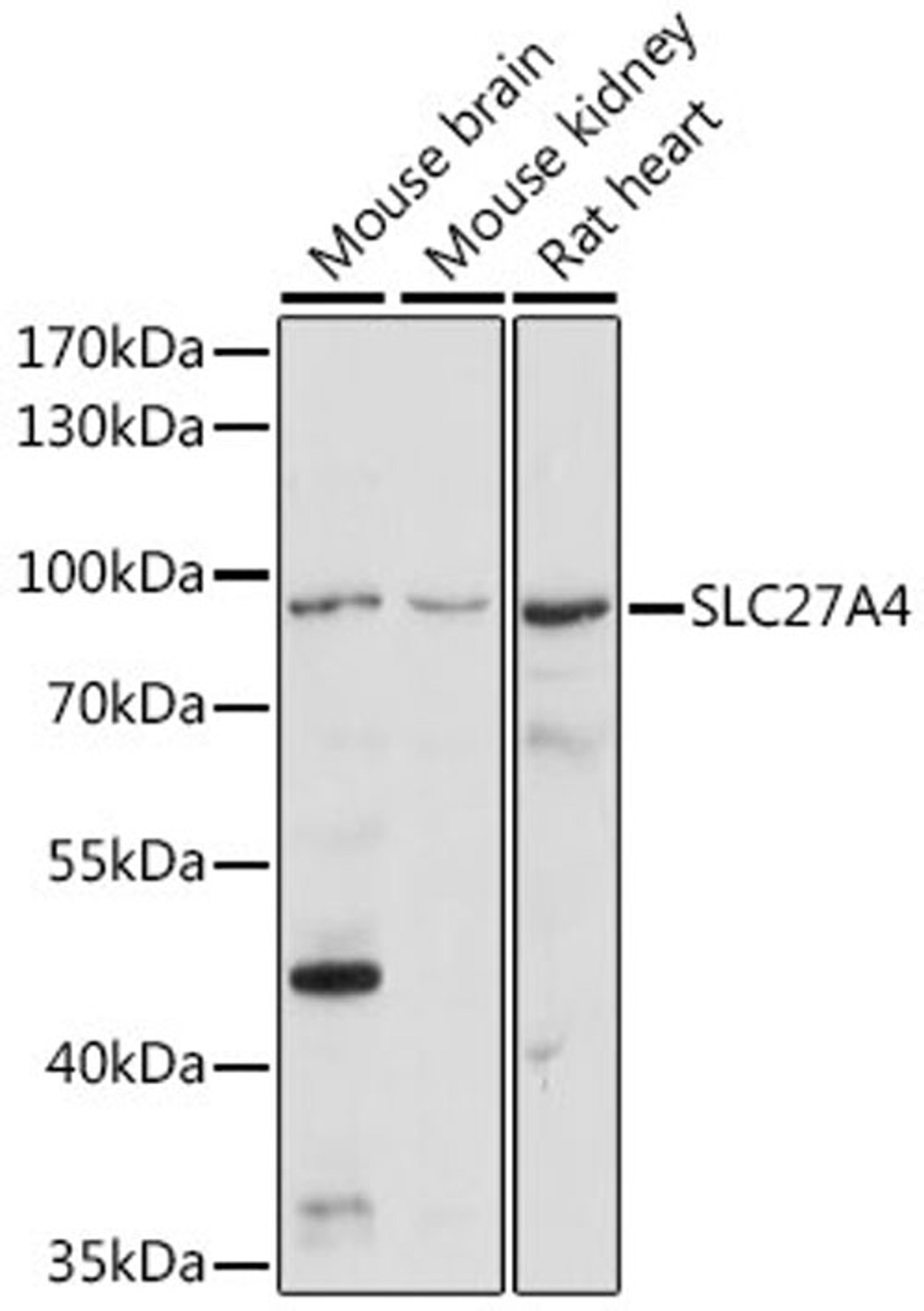 Western blot - SLC27A4 antibody (A16101)