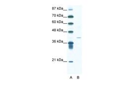 Antibody used in WB on Human Jurkat 1.25 ug/ml.