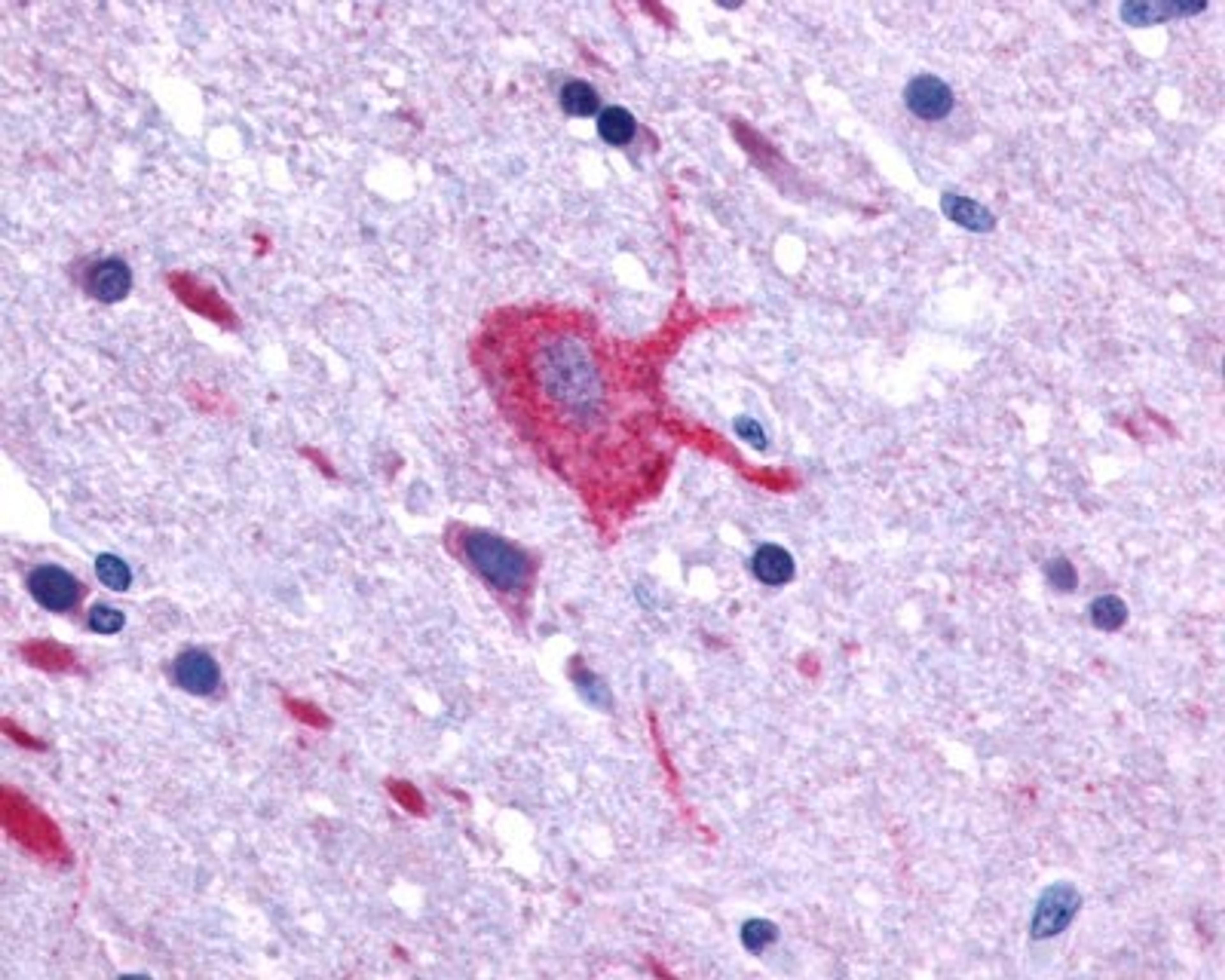 Immunohistochemistry-Paraffin: Lgr4/GPR48 Antibody [NLS3593] - Analysis of anti-GPR48 / LGR4 antibody with brain, neurons and glia at 7 ug/ml.