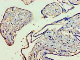 Immunohistochemistry of paraffin-embedded human placenta tissue using CSB-PA012475LA01HU at dilution of 1:100