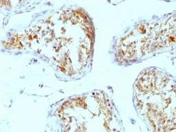 Formalin-fixed, paraffin-embedded human testicular carcinoma stained with Perlecan antibody (A7L6).