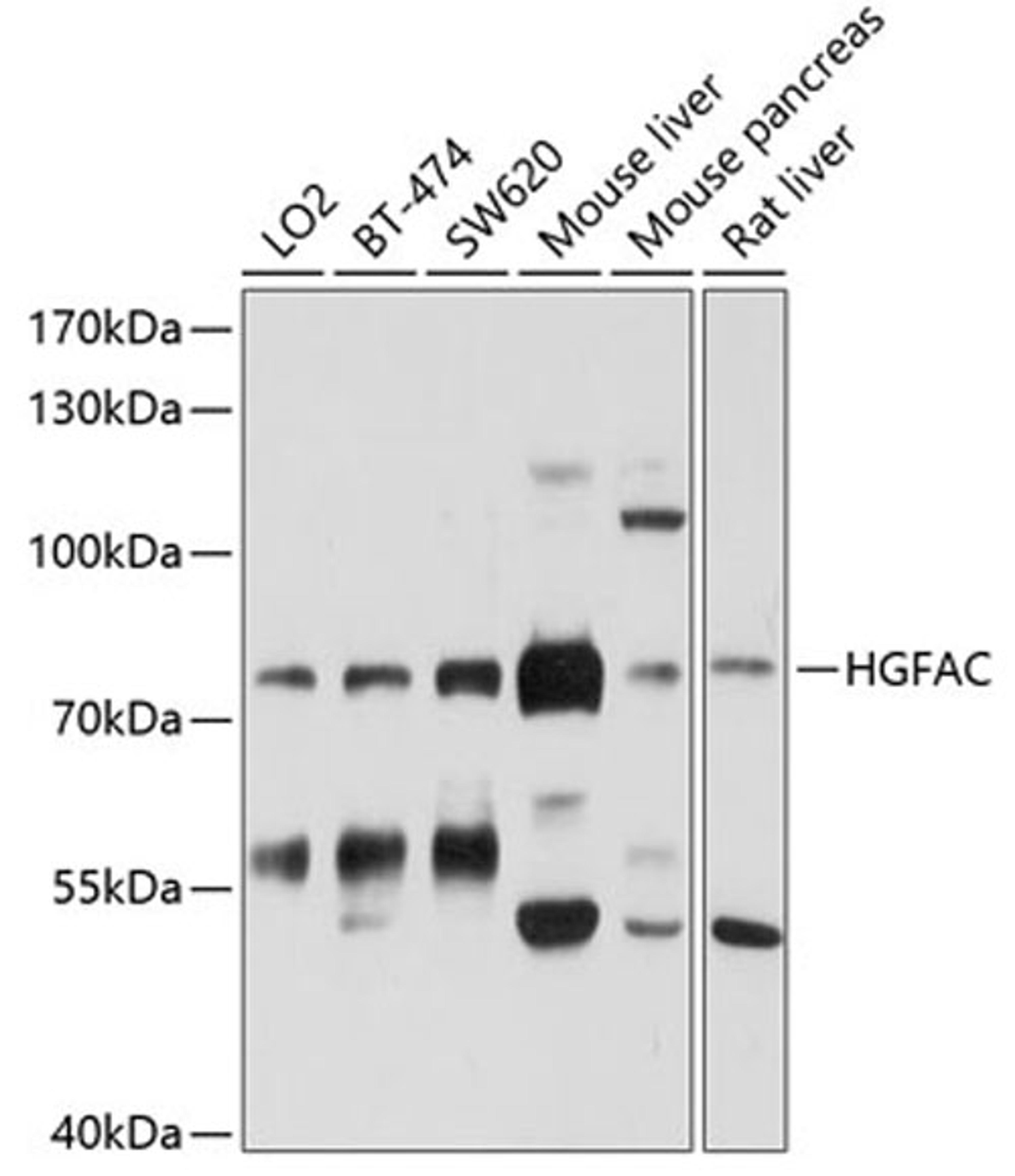 Western blot - HGFAC antibody (A10114)