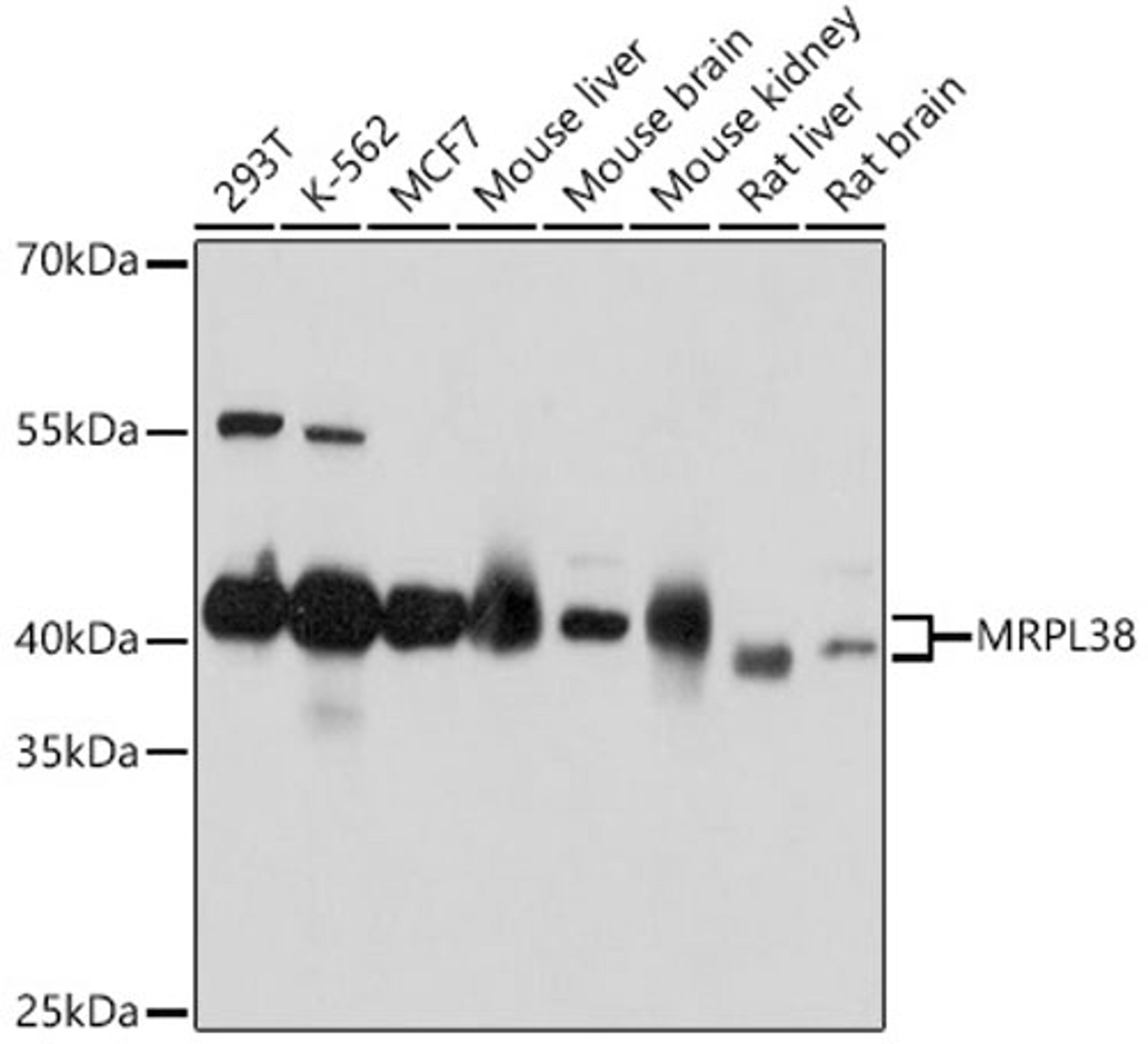 Western blot - MRPL38 antibody (A18239)