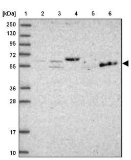 Western Blot: TEKT1 Antibody [NBP1-92487] - Lane 1: Marker [kDa] 250, 130, 95, 72, 55, 36, 28, 17, 10<br/>Lane 2: Human cell line RT-4<br/>Lane 3: Human cell line U-251MG sp<br/>Lane 4: Human plasma (IgG/HSA depleted)<br/>Lane 5: Human liver tissue<br/>Lane 6: Human tonsil tissue