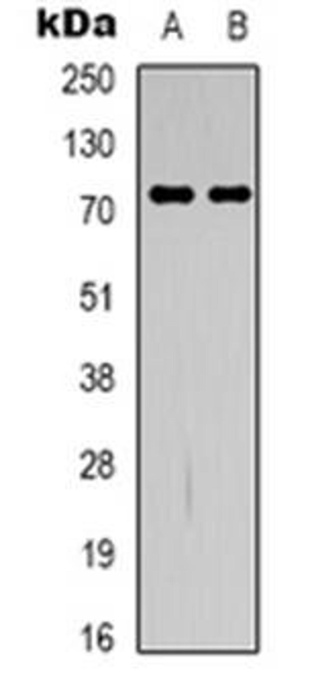 Western blot analysis of GBP4 expression in HepG2 (Lane 1), RAW264.7 (Lane 2) whole cell lysates using GBP4 antibody