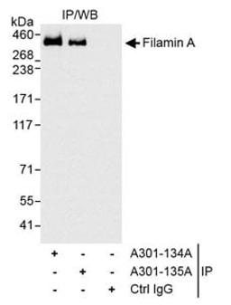 Detection of human Filamin A by western blot of immunoprecipitates.