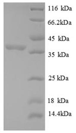 (Tris-Glycine gel) Discontinuous SDS-PAGE (reduced) with 5% enrichment gel and 15% separation gel.