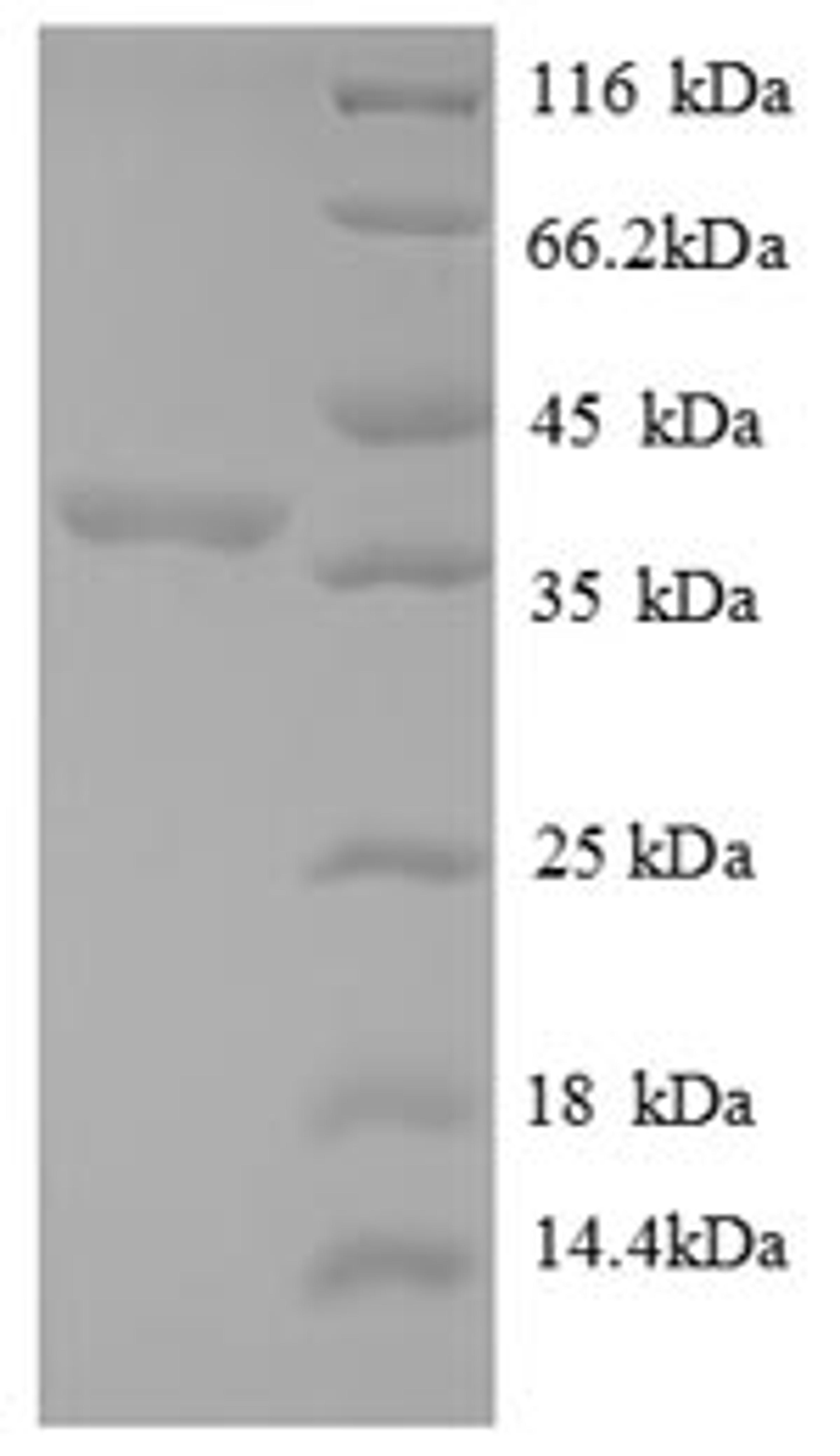 (Tris-Glycine gel) Discontinuous SDS-PAGE (reduced) with 5% enrichment gel and 15% separation gel.