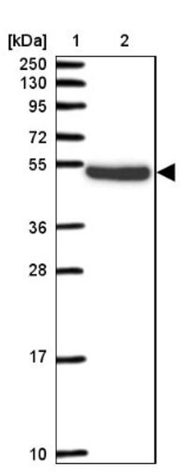 Western Blot: Pellino 2 Antibody [NBP2-33679] - Lane 1: Marker [kDa] 250, 130, 95, 72, 55, 36, 28, 17, 10<br/>Lane 2: Human cell line RT-4