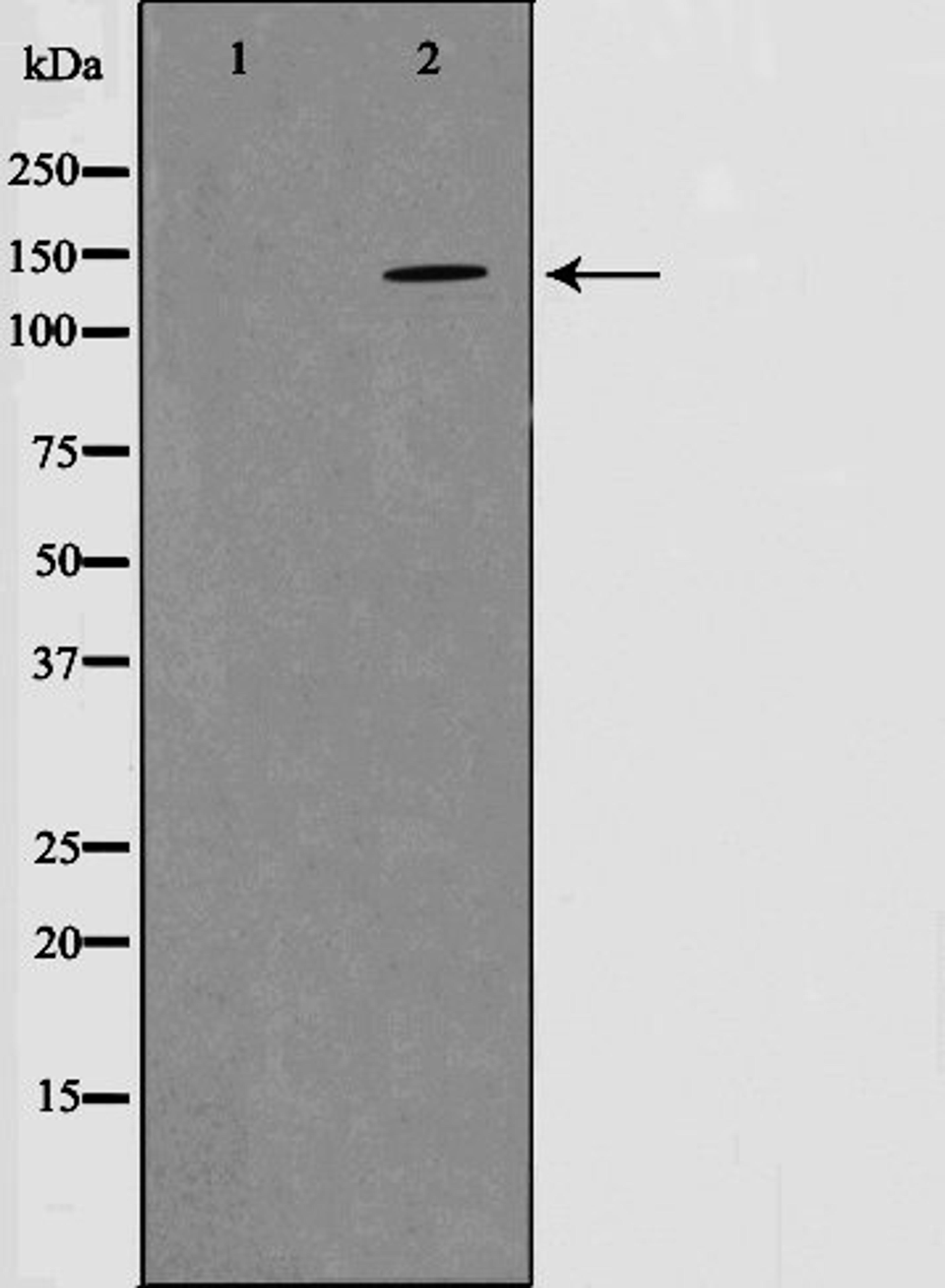 Western blot analysis of mouse brain cell lysate using PYK2 (Phospho-Tyr580) antibody