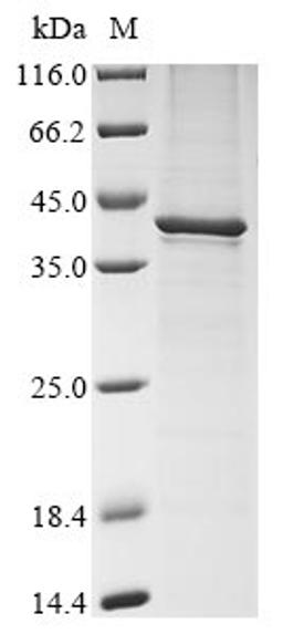 (Tris-Glycine gel) Discontinuous SDS-PAGE (reduced) with 5% enrichment gel and 15% separation gel.