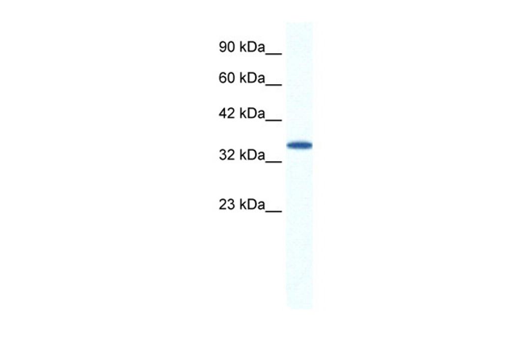 Antibody used in WB on Human Jurkat cells at 1.25 ug/ml.